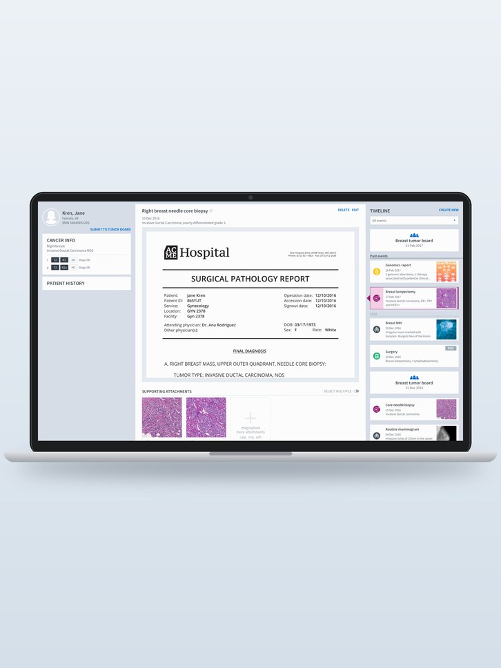 navify tumor board patient view on a laptop, with a pathology report and a timeline of patient events