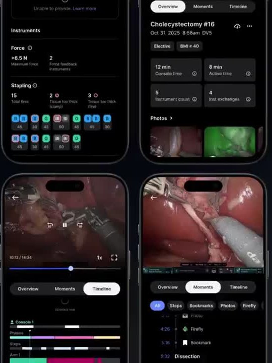 Case review screens in the My Intuitive app